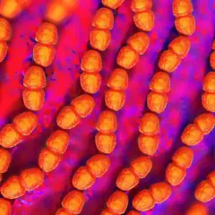 Rzędy pomarańczowych bakterii, przypominających ziarna, to Enterococcus faecalis. Tworzą one łańcuszki, unosząc się w fioletowo-czerwonym środowisku.