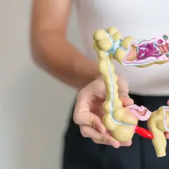 Model jelita grubego z widocznymi zmianami, które mogą symbolizować częste gazy i raka.