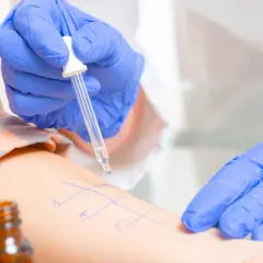 Alergia: Lekarz rodzinny zleci testy NFZ? Nowe zasady 2023