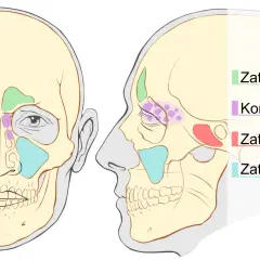 Zapalenie zatoki klinowej: objawy, które ratują wzrok i życie