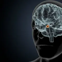 Guz przysadki a psychika: Kiedy to nie depresja, a hormon?