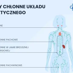 Schemat układu limfatycznego. Pokazuje rozmieszczenie węzłów chłonnych: szyjnych, pachowych, w jamie brzusznej i klatce piersiowej, pachwinowych. To ważny element odpowiedzi immunologicznej, czyli limfa co to jest.