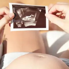Kobieta trzyma zdjęcie USG, na którym widać zarodek. To nie lewatywa, co to jest? To obraz życia.