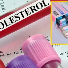 Najmniej szkodliwy lek na cholesterol? Klucz to wybór lekarza