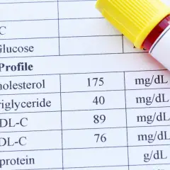 Wynik lipidogramu: cholesterol całkowity 175 mg/dL, trójglicerydy 40 mg/dL, HDL-C 89 mg/dL, LDL-C 76 mg/dL. Wartość cholesterolu nie-HDL jest w normie.