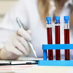 Laborantka w rękawiczkach analizuje próbki krwi, badając czas protrombinowy.