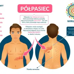 Półpasiec u dorosłych: Czy to te objawy? Kiedy pilnie do lekarza?