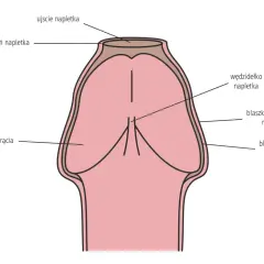 Schemat penisa z napletkiem. Pokazuje, co to stulejka – zwężenie napletka utrudniające jego odprowadzenie.