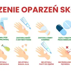Leczenie oparzeń skóry: chłodna woda, maść z antybiotykiem, zimny kompres, leki przeciwbólowe, aloes. Unikaj masła, jajka, pasty do zębów, lodu. Nie przekłuwaj pęcherza.