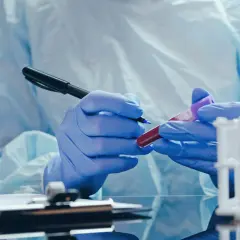 Jakie badania zleca trycholog? Pełny przewodnik przed wizytą