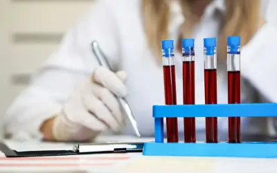 Laborantka w rękawiczkach analizuje próbki krwi, badając czas protrombinowy.