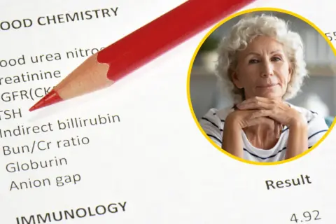 TSH: Co to za badanie? Interpretuj wyniki jak ekspert!
