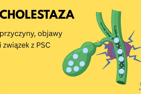 Ilustracja przedstawia żółciowy pęcherzyk i przewód żółciowy z zastojem żółci, symbolizującym cholestazę.
