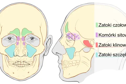 Zapalenie zatoki klinowej: objawy, które ratują wzrok i życie