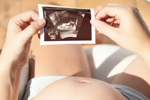 Kobieta trzyma zdjęcie USG, na którym widać zarodek. To nie lewatywa, co to jest? To obraz życia.
