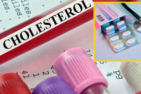 Najmniej szkodliwy lek na cholesterol? Klucz to wybór lekarza