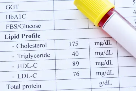 Wynik lipidogramu: cholesterol całkowity 175 mg/dL, trójglicerydy 40 mg/dL, HDL-C 89 mg/dL, LDL-C 76 mg/dL. Wartość cholesterolu nie-HDL jest w normie.