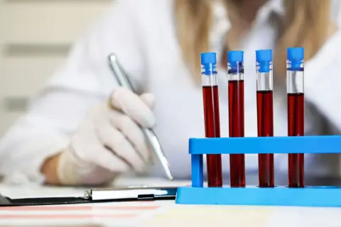 Laborantka w rękawiczkach analizuje próbki krwi, badając czas protrombinowy.