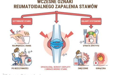 Wczesne objawy reumatyzmu: sztywność stawów, opuchlizna, zmęczenie, utrata apetytu i gorączka.