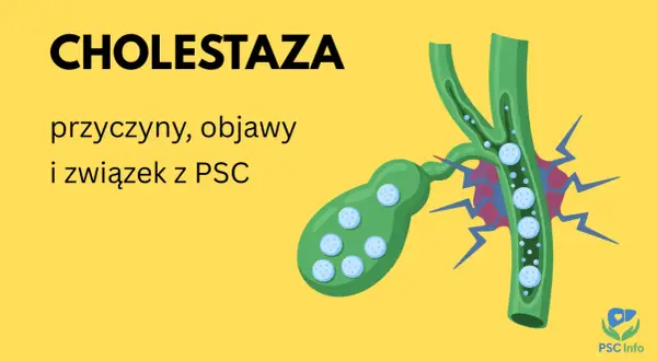 Ilustracja przedstawia żółciowy pęcherzyk i przewód żółciowy z zastojem żółci, symbolizującym cholestazę.