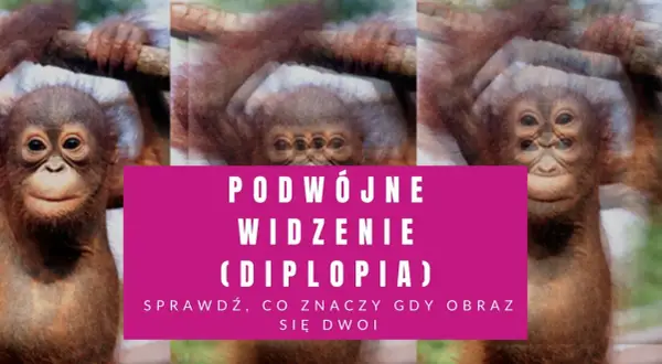 Podwójne widzenie: Czy to udar? Neurologiczne sygnały