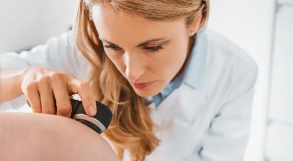 Do jakiego lekarza z pieprzykiem? Dermatolog radzi, nie zwlekaj!