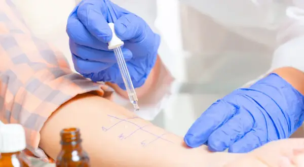 Alergia: Lekarz rodzinny zleci testy NFZ? Nowe zasady 2023