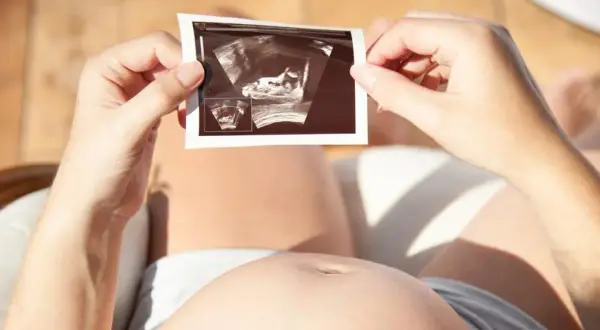 Kobieta trzyma zdjęcie USG, na którym widać zarodek. To nie lewatywa, co to jest? To obraz życia.