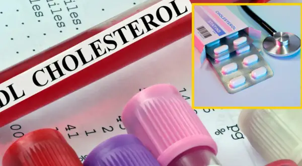 Najmniej szkodliwy lek na cholesterol? Klucz to wybór lekarza