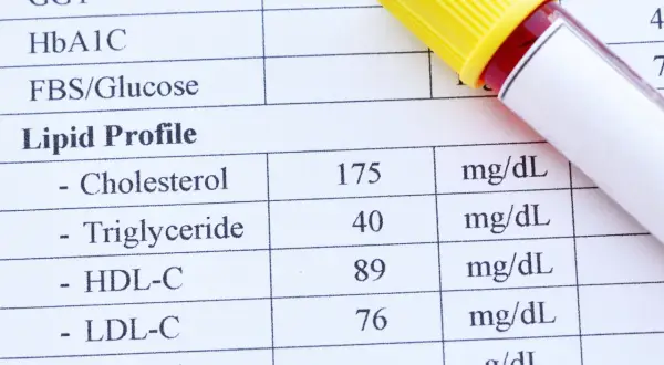 Wynik lipidogramu: cholesterol całkowity 175 mg/dL, trójglicerydy 40 mg/dL, HDL-C 89 mg/dL, LDL-C 76 mg/dL. Wartość cholesterolu nie-HDL jest w normie.