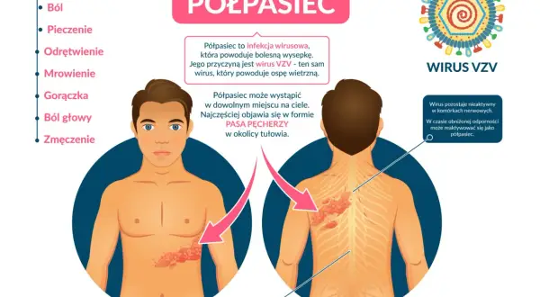 Półpasiec u dorosłych: Czy to te objawy? Kiedy pilnie do lekarza?