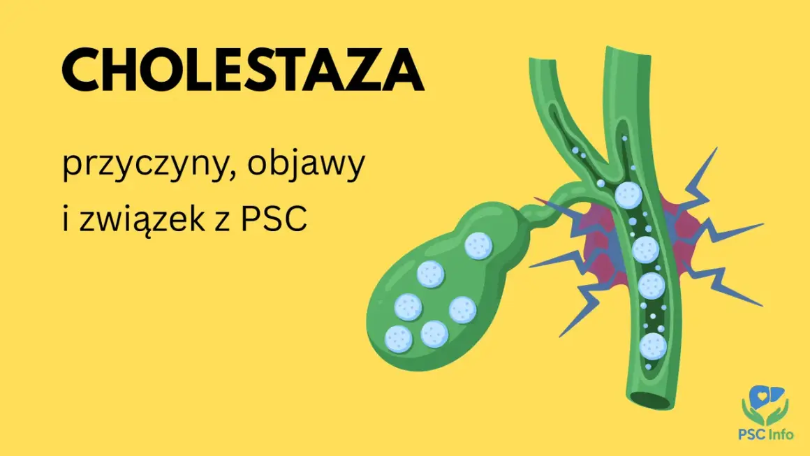 Ilustracja przedstawia żółciowy pęcherzyk i przewód żółciowy z zastojem żółci, symbolizującym cholestazę.