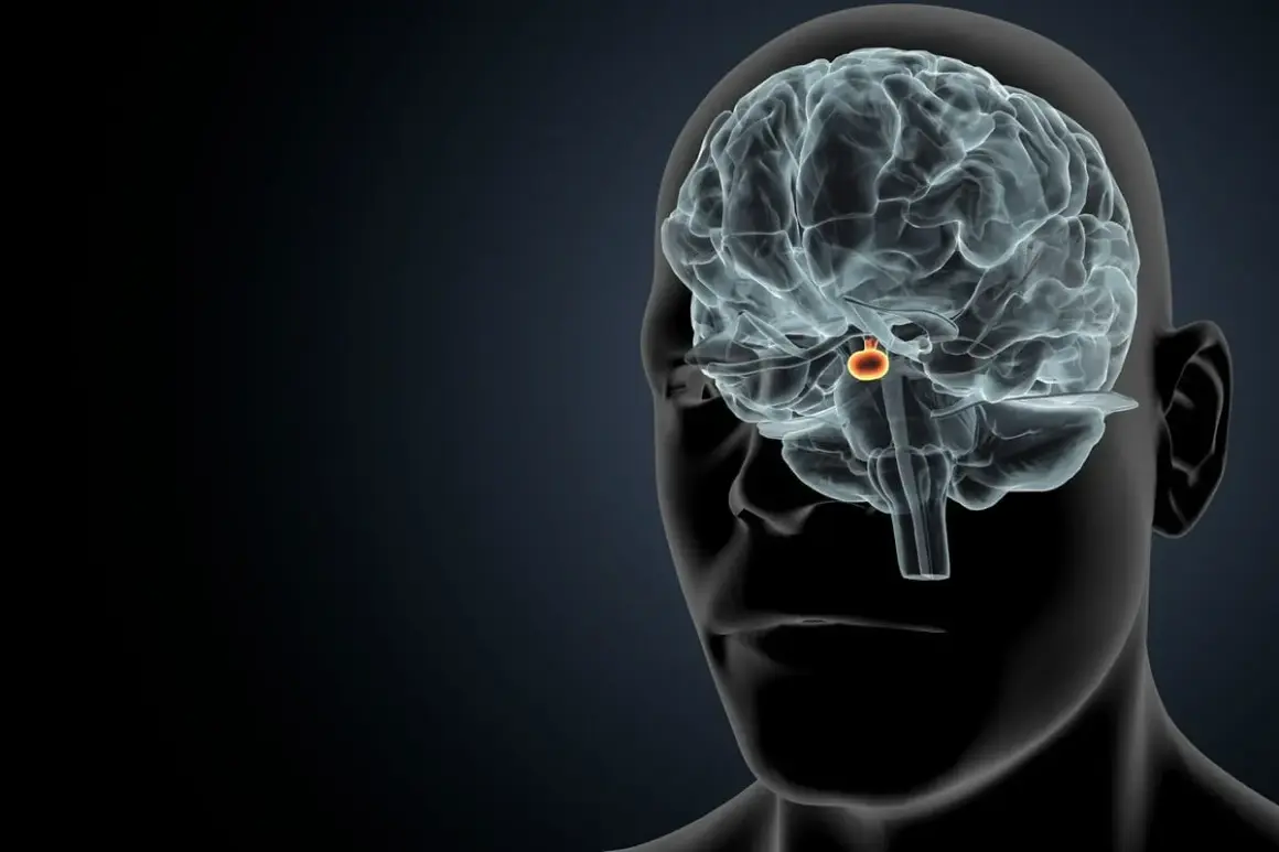 Guz przysadki a psychika: Kiedy to nie depresja, a hormon?