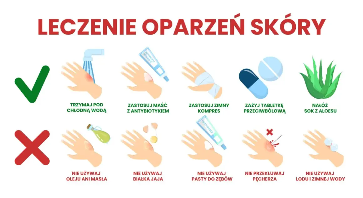Leczenie oparzeń skóry: chłodna woda, maść z antybiotykiem, zimny kompres, leki przeciwbólowe, aloes. Unikaj masła, jajka, pasty do zębów, lodu. Nie przekłuwaj pęcherza.