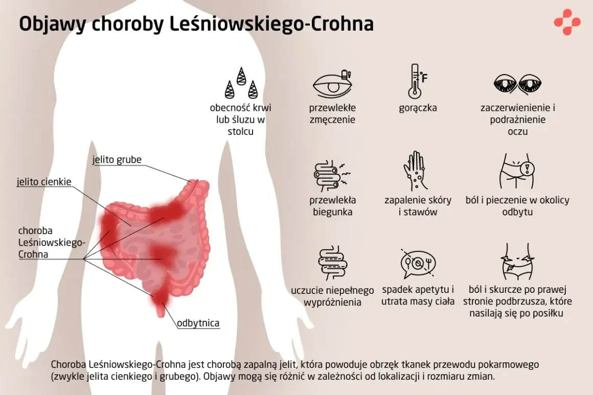 Objawy choroby Leśniowskiego-Crohna: krew w stolcu, zmęczenie, gorączka, zaczerwienienie oczu, biegunka, bóle brzucha, zapalenie skóry i stawów.