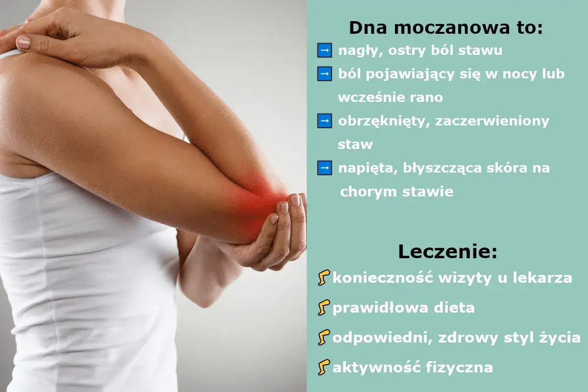 Leczenie dny moczanowej i profilaktyka