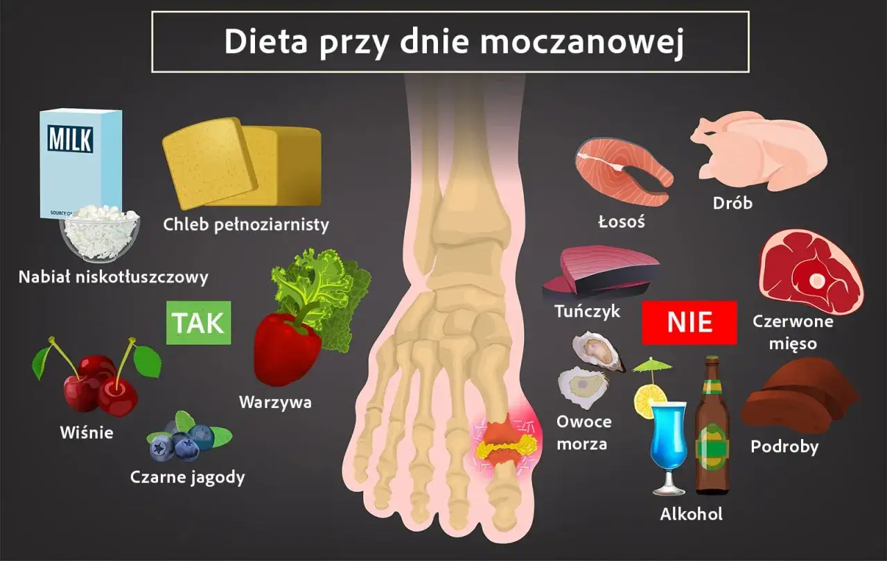 Dieta przy dnie moczanowej: TAK - nabiał niskotłuszczowy, chleb pełnoziarnisty, warzywa, wiśnie, czarne jagody. NIE - drób, łosoś, tuńczyk, czerwone mięso, podroby, owoce morza, alkohol. Hiperurykemia wymaga ostrożności.