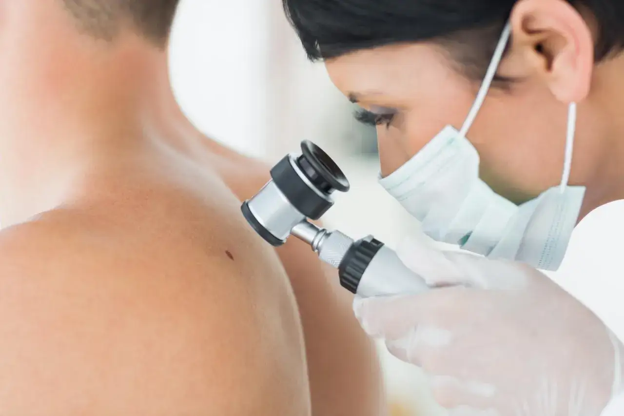 Lekarz dermatolog bada pieprzyki