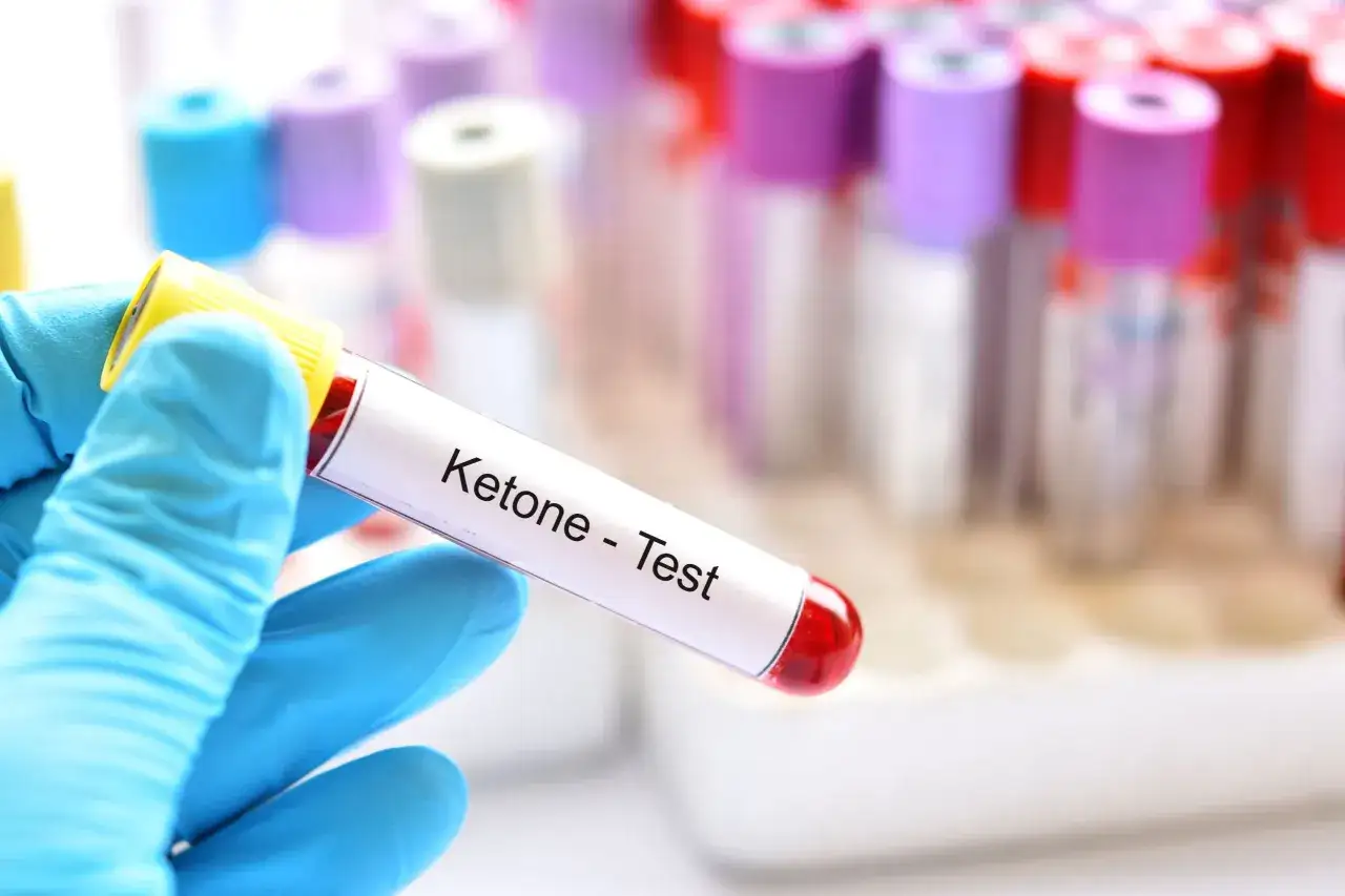 Rękawiczka w niebieskiej rękawiczce trzyma probówkę z krwią do testu na ketony, co może pomóc w diagnozowaniu kwasicy ketonowej.