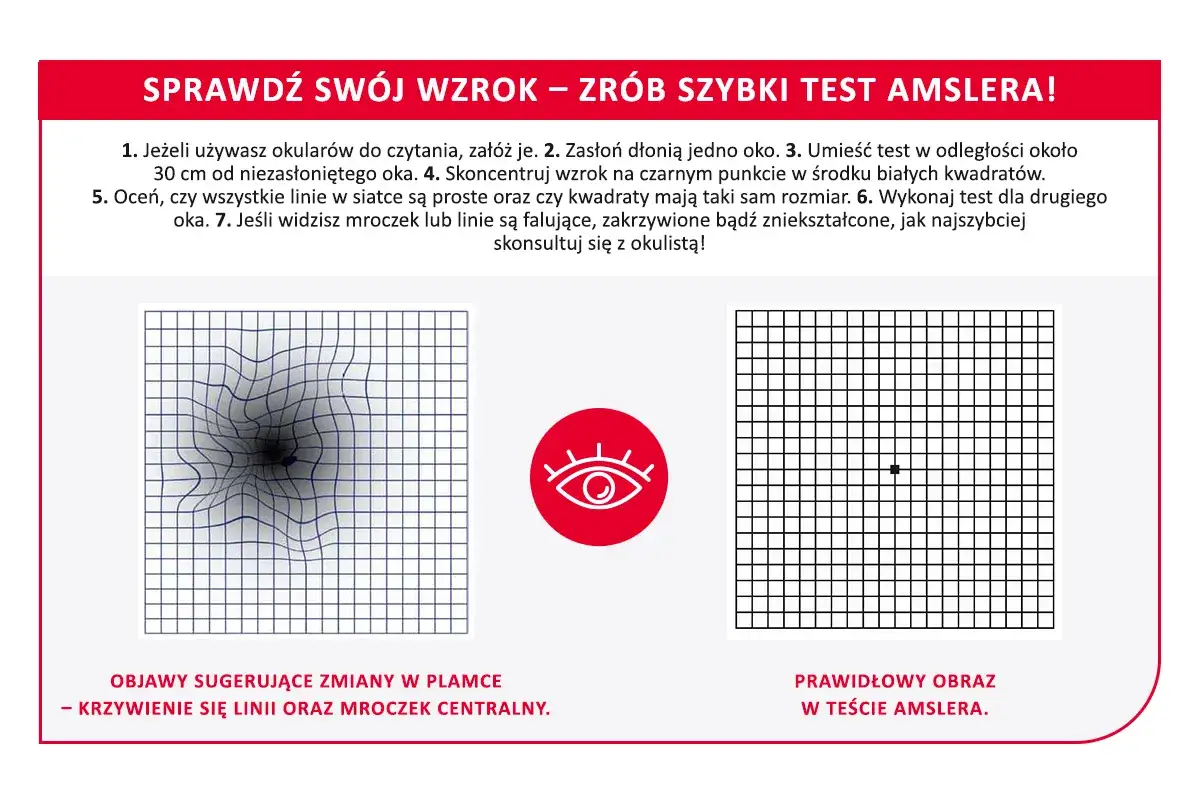 Test Amslera pokazuje zniekształcone linie i mroczek, co może sugerować zwyrodnienie plamki żółtej. Prawidłowy obraz jest prosty.