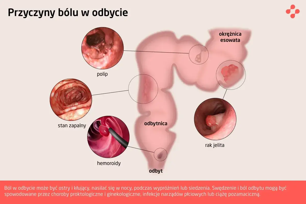 Lekarz proktolog
