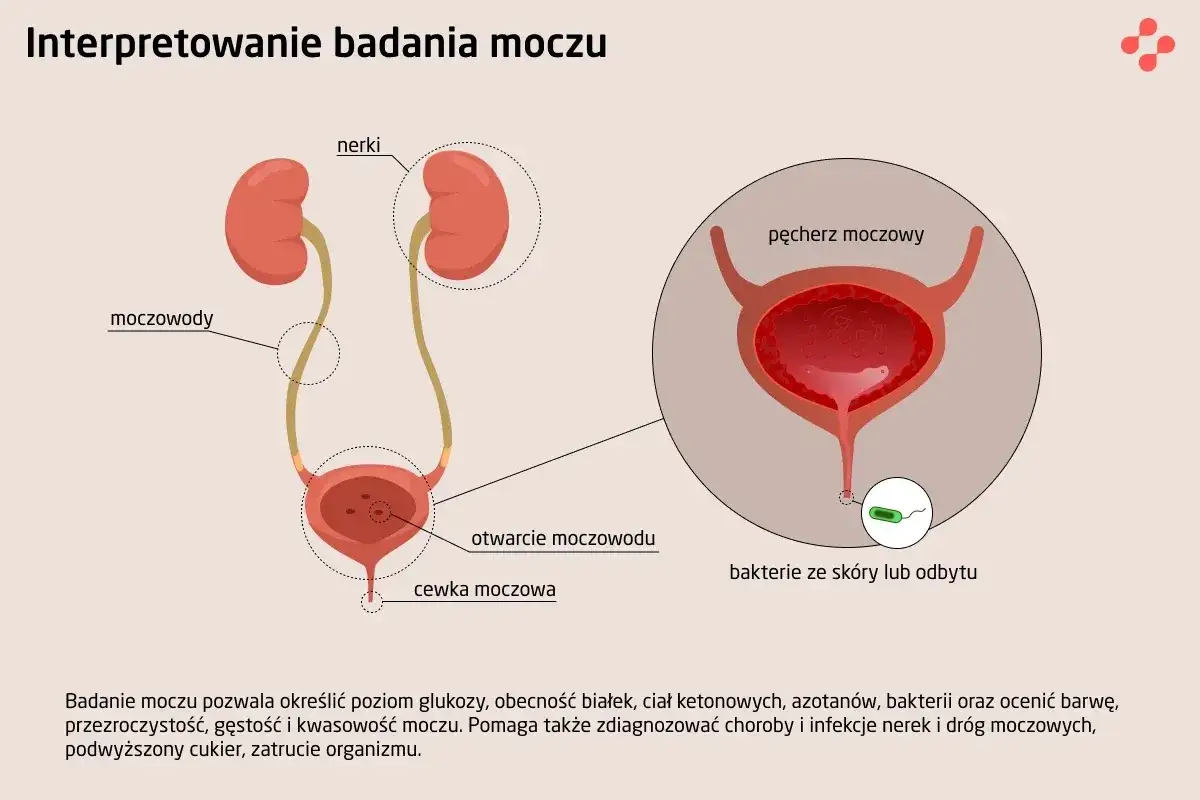 analiza moczu laboratorium