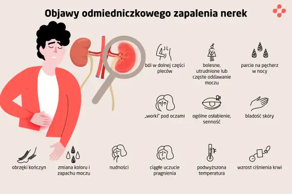 Objawy zapalenia nerek: Czy Twoje nerki wołają o pomoc?
