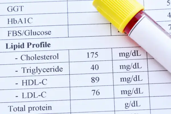 Wynik lipidogramu: cholesterol całkowity 175 mg/dL, trójglicerydy 40 mg/dL, HDL-C 89 mg/dL, LDL-C 76 mg/dL. Wartość cholesterolu nie-HDL jest w normie.
